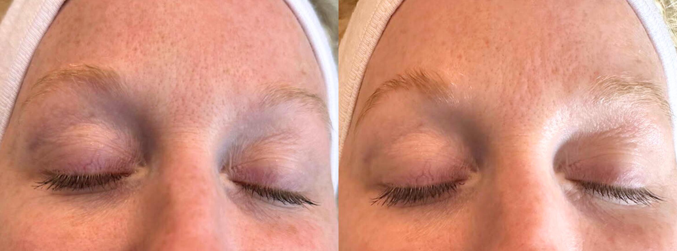 Before & After Eyebrow Tint and Lamination Case 1 View 1 View in Virginia Beach, VA